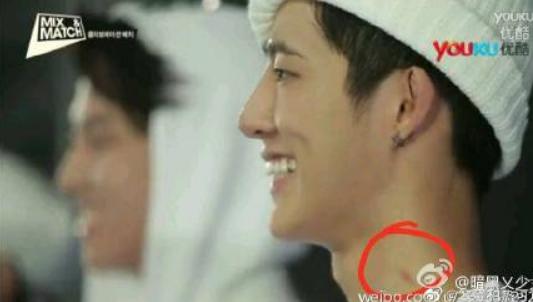 金韩彬脖子吻痕图(金泰妍吻痕)