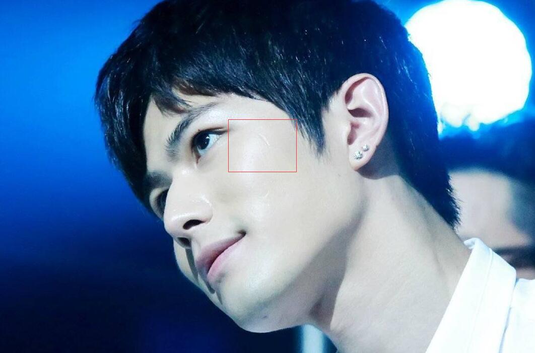 陈学冬为什么凉了没戏了？陈学冬的疤好明显