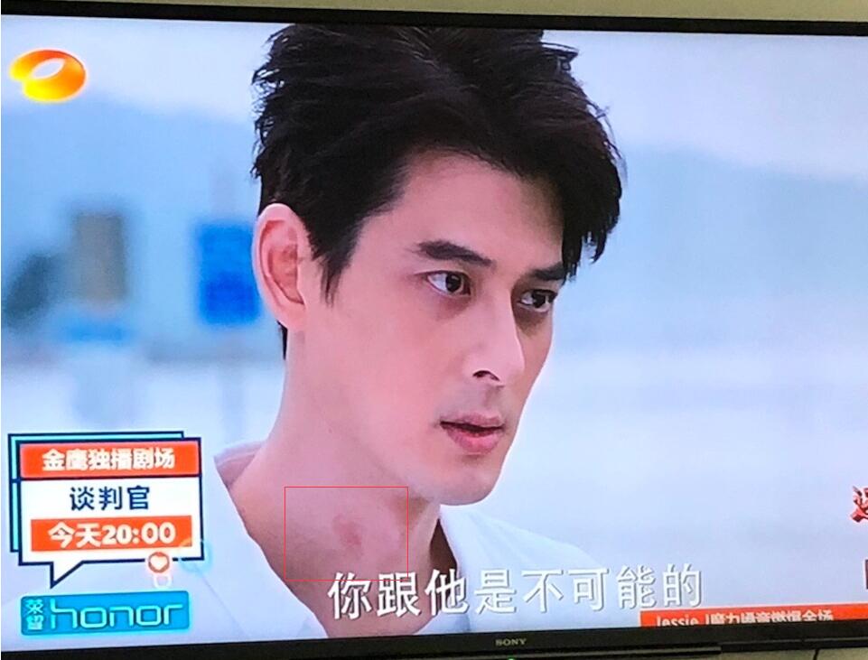 郭品超脖子上是什么？郭品超怎么帮助杨幂了