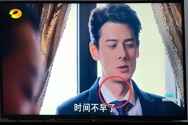 郭品超脖子上是什么？郭品超怎么帮助杨幂了