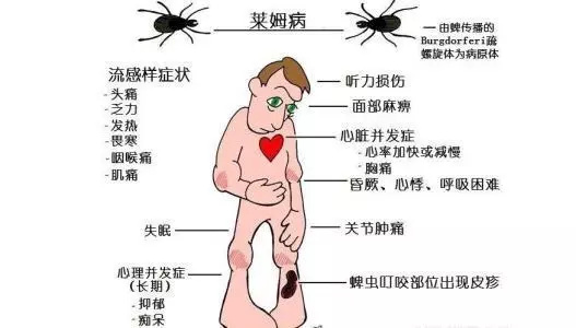 艾薇儿al6是什么梗？艾薇儿怎么得的莱姆