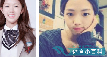 蔡秀彬整容前后对比图(蔡秀彬生活照) 蔡秀彬整容前后对比图(蔡秀彬生活照)