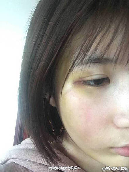 许凯家暴大金的照片曝光(许凯的网红女友大金长什么样)