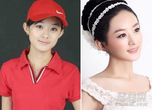 赵丽颖的鼻子整容过吗？丽颖的鼻子越来越高