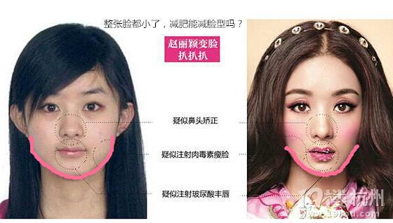 赵丽颖的鼻子整容过吗？丽颖的鼻子越来越高