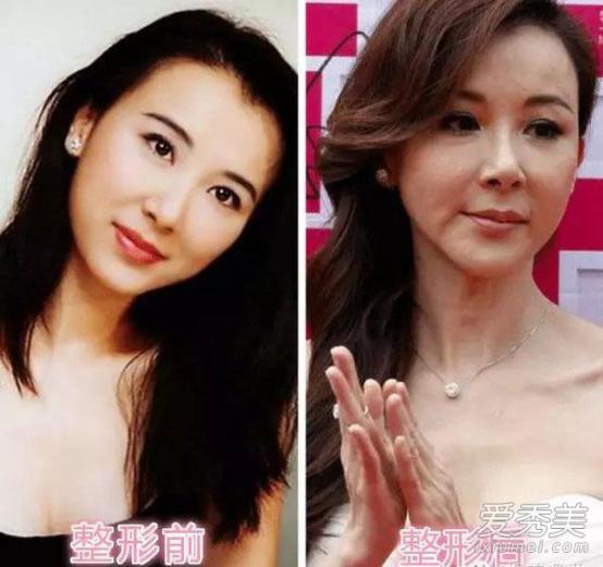 萧蔷和张菲的绯闻细节(萧蔷结婚了)