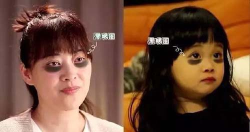 梅婷为什么不去黑眼圈？梅婷的黑眼圈怎么那(梅婷为什么总是黑眼圈)