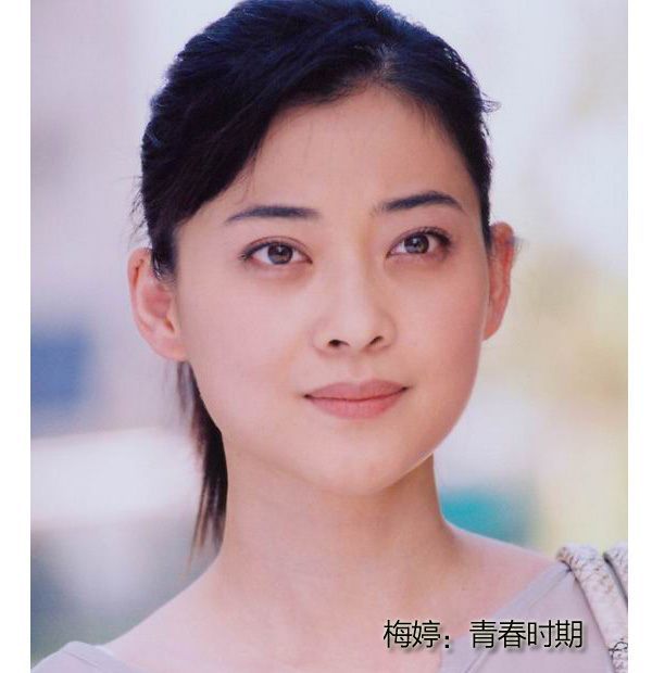 梅婷为什么不去黑眼圈？梅婷的黑眼圈怎么那(梅婷为什么总是黑眼圈)