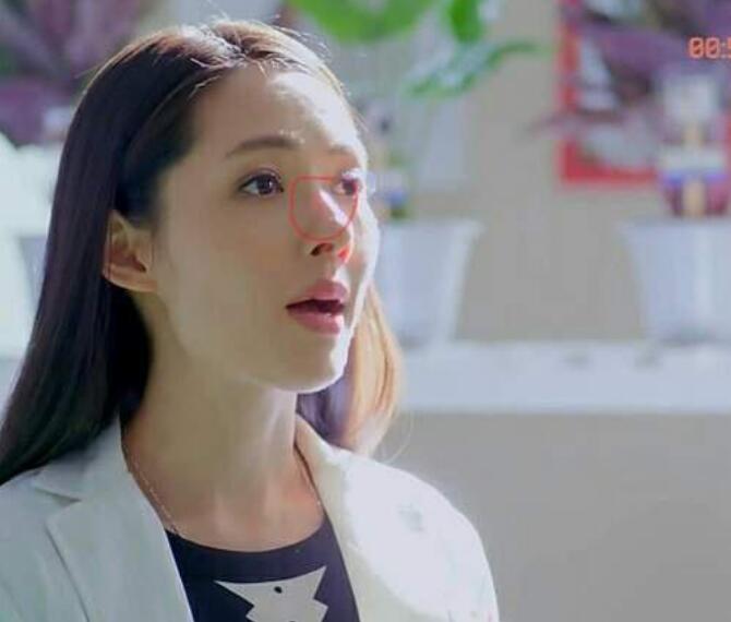 郭碧婷鼻子整过吗怎么塌陷有点歪
