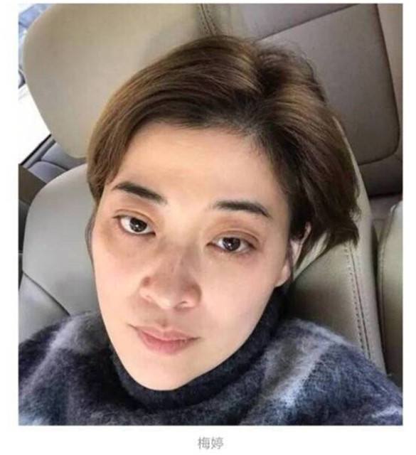 梅婷为什么不去黑眼圈？梅婷的黑眼圈怎么那(梅婷为什么总是黑眼圈)