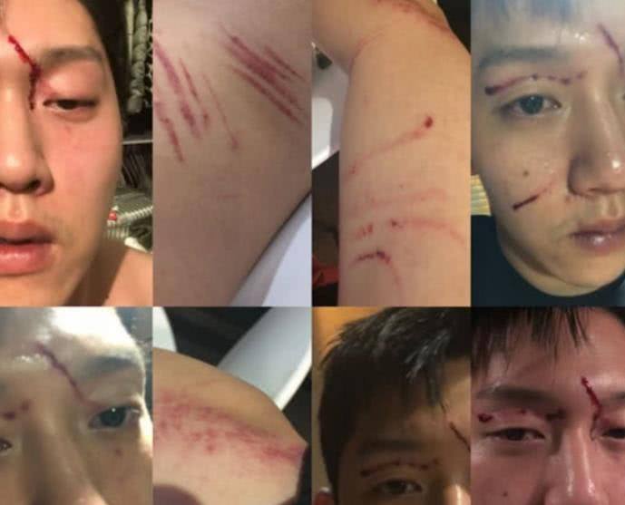 具荷拉家暴事件始末(附受伤图) 具荷拉家暴事件始末(附受伤图)