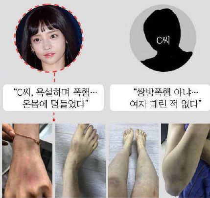 具荷拉家暴事件始末(附受伤图) 具荷拉家暴事件始末(附受伤图)