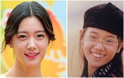 克拉拉整容前照片什么样?克拉拉演过什么禁 克拉拉整容前照片什么样?克拉拉演过什么禁