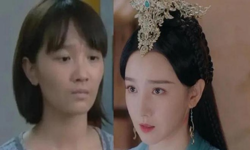 陈小纭整骨近十次(陈小纭削过骨吗)