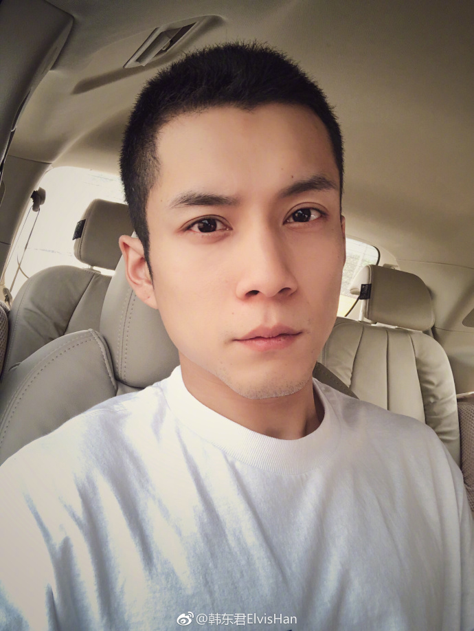 韩东君割双眼皮整容前后对比照