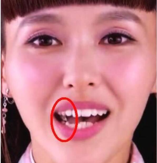 唐嫣为什么叫口香糖、牙博士、大狐狸、千金