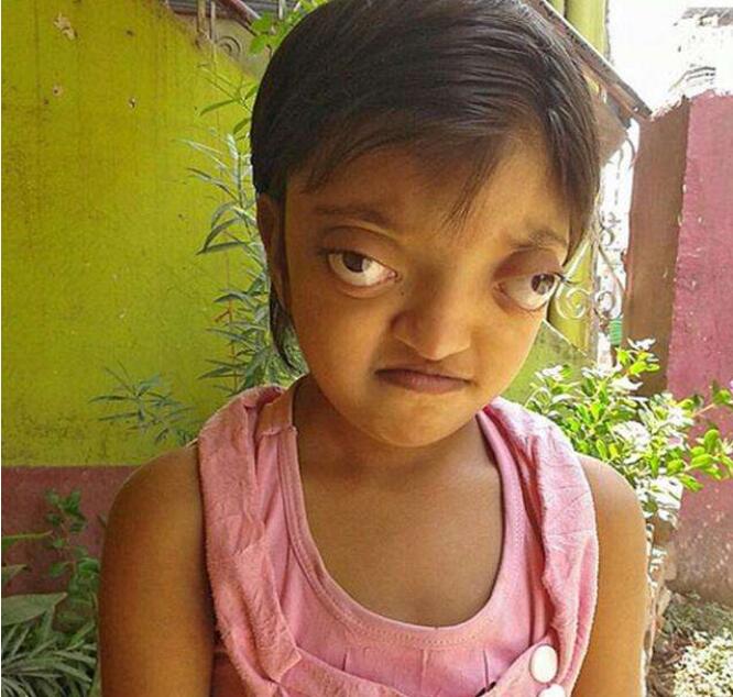 真实的金鱼眼是什么样子图片(金鱼眼女人图片)