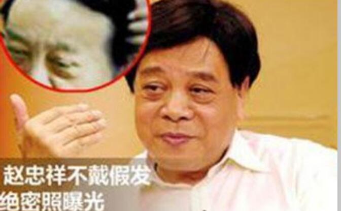 赵忠祥年轻时是不是秃顶