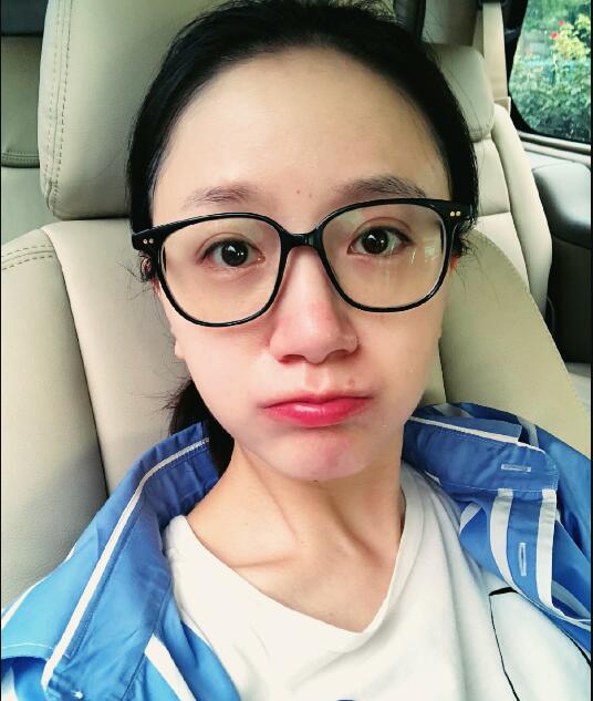 李倩为什么把痣点掉了(李倩的痣怎么没有了) 李倩为什么把痣点掉了(李倩的痣怎么没有了)