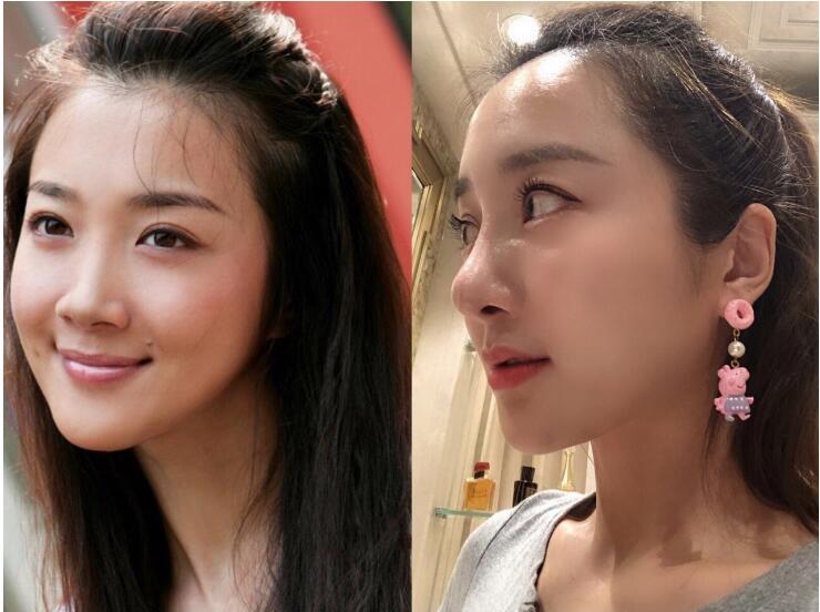 李依晓以前长什么样子照片(李依晓长得像) 李依晓以前长什么样子照片(李依晓长得像)