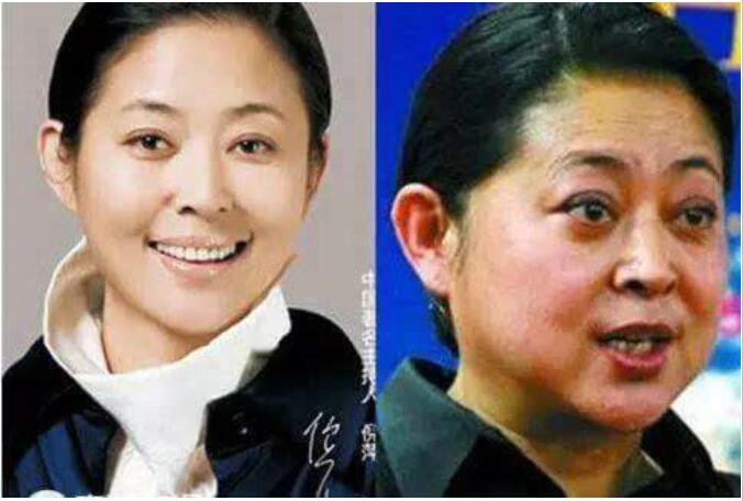 倪萍患甲亢前后对比照片(倪萍甲亢好了吗) 倪萍患甲亢前后对比照片(倪萍甲亢好了吗)