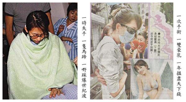 林志玲胸部盐水袋破裂事件回顾