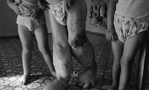 切尔诺贝利事件变种人曝光(切尔诺贝利事件变异后的人类图片)