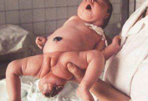 切尔诺贝利事件变种人曝光(切尔诺贝利事件变异后的人类图片)