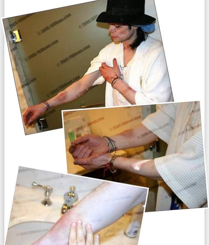 杰克逊跳舞时鼻子掉的场面图(杰克逊鼻子掉了长什么样子)