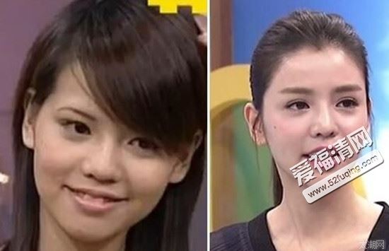 李毓芬和柯震东在一起了吗？李毓芬整容前后