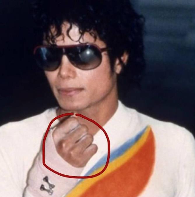 杰克逊跳舞时鼻子掉的场面图(杰克逊鼻子掉了长什么样子)