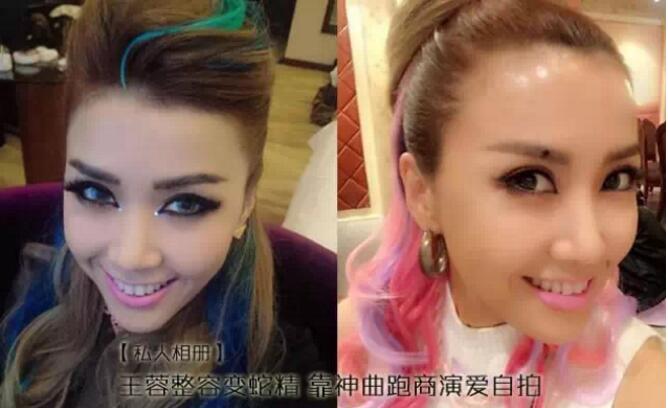 王蓉精神病是怎么得上的(王蓉为什么变神经病) 王蓉精神病是怎么得上的(王蓉为什么变神经病)