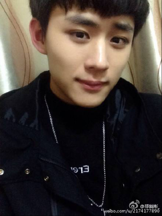 郑锐彬整容前后对比图