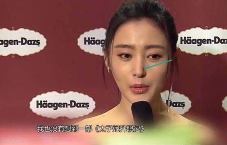 张天爱鼻子太假了是整过吗？杨洋张天爱分手