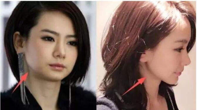 谢娜下巴向前翘面相好吗(下巴往前翘面相好不好)