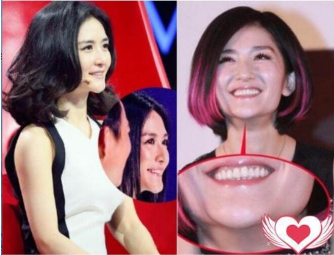 谢娜下巴向前翘面相好吗(下巴往前翘面相好不好)