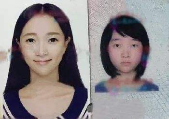 网红雪梨整容前后照片(网红雪梨的脸怎么了)