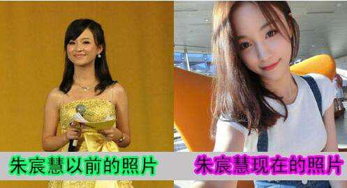 网红雪梨整容前后照片(网红雪梨的脸怎么了)