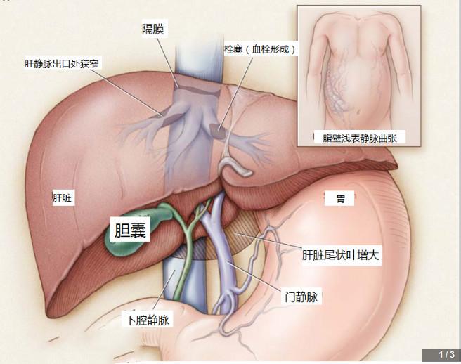 大肚女孩胡云星现状如何(大肚女孩小云星好了吗) 大肚女孩胡云星现状如何(大肚女孩小云星好了吗)