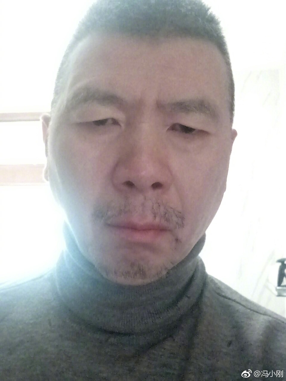 冯小刚白斑病自愈了真的吗？他白斑病最新的