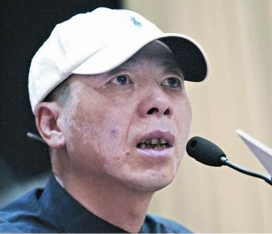 冯小刚白斑病自愈了真的吗？他白斑病最新的