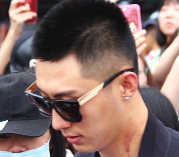 黄景瑜脖子上的吻痕是怎么回事