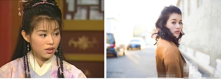 胡杏儿整牙前后对比照片(胡杏儿牙套)