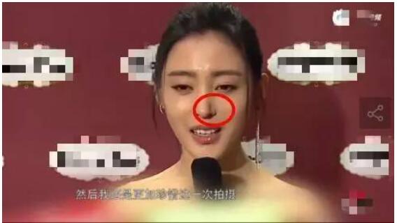 张天爱鼻子整过容吗？她和张若昀是什么关系