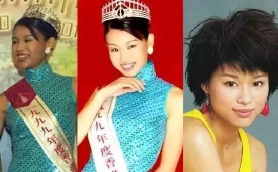 胡杏儿整牙前后对比照片(胡杏儿牙套)