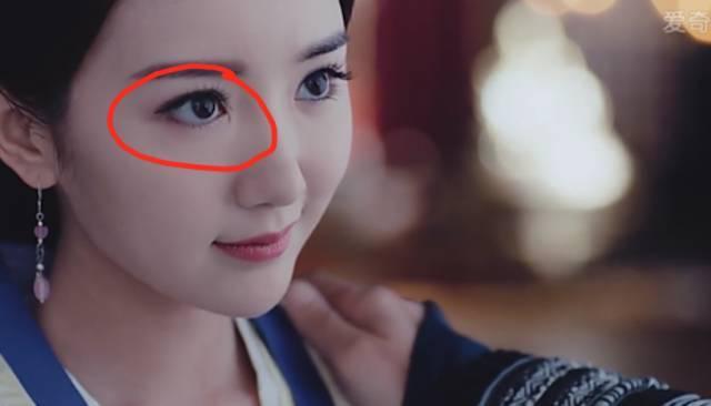 毛晓彤眼角的疤好明显照片(毛晓彤开眼角留疤图片) 毛晓彤眼角的疤好明显照片(毛晓彤开眼角留疤图片)