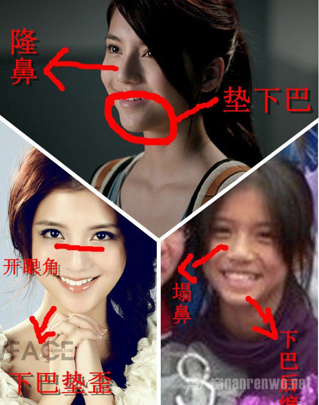 吴千语整容前后对比图(吴千语颜值分析)