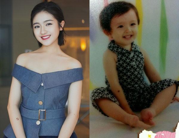 李兰迪为什么叫瞳孔女神？李兰迪手臂上是胎