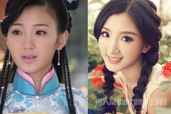 毛晓彤眼角的疤好明显照片(毛晓彤开眼角留疤图片) 毛晓彤眼角的疤好明显照片(毛晓彤开眼角留疤图片)