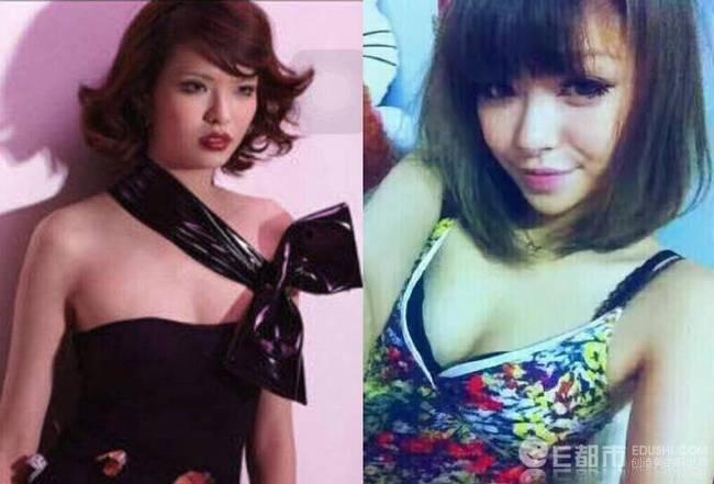 奶油米naomi康雅馨整容前龅牙照片